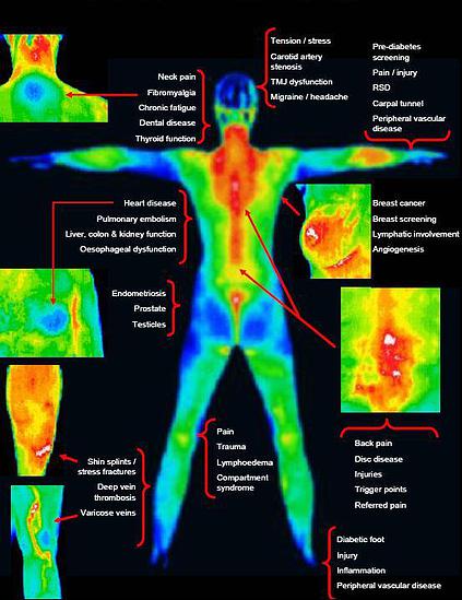 Thermal Imaging Options The Health Dimension